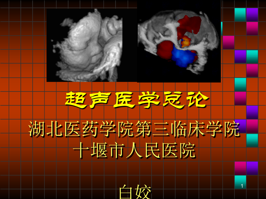 超声总论-1.ppt_第1页