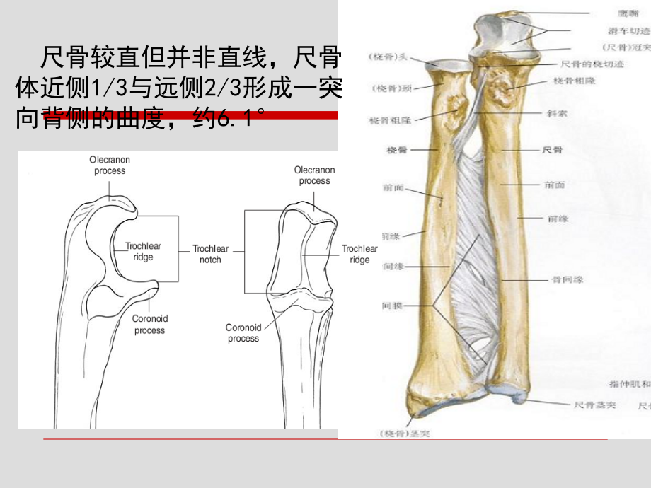 尺骨骨折和骨间膜.ppt_第2页