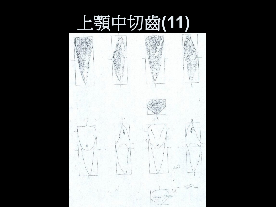 牙齿形态-上颚.ppt_第2页