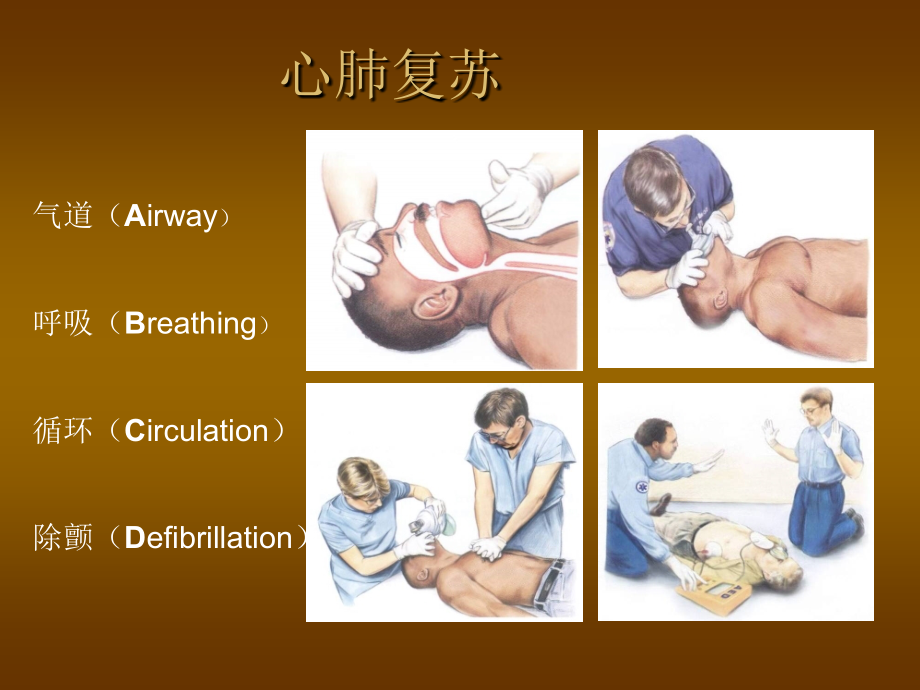 美国AHA心肺复苏指南解读.ppt_第2页
