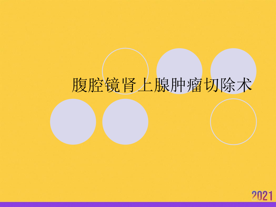腹腔镜肾上腺肿瘤切除术2021推选.ppt_第1页