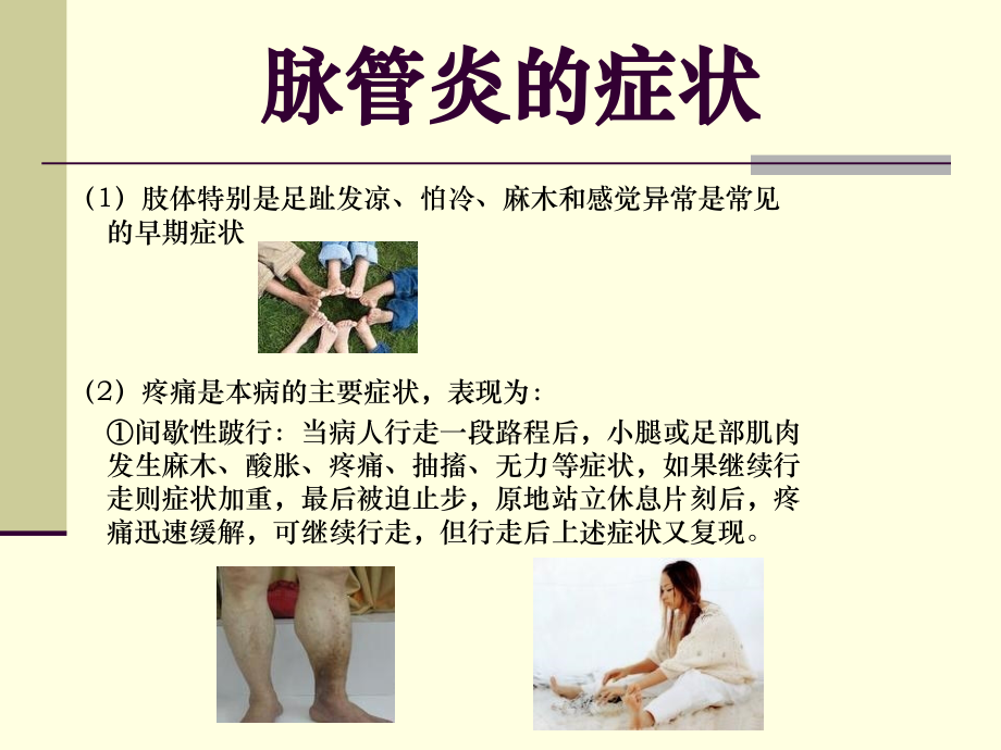 脉管炎的症状图片.ppt_第2页