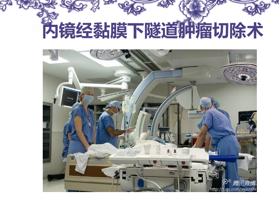 内镜经黏膜下隧道肿瘤切除术.ppt_第1页