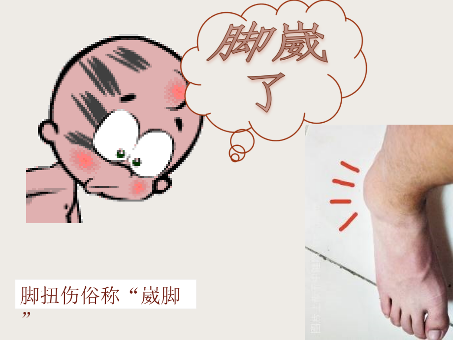 踝扭伤应急处理.ppt_第2页