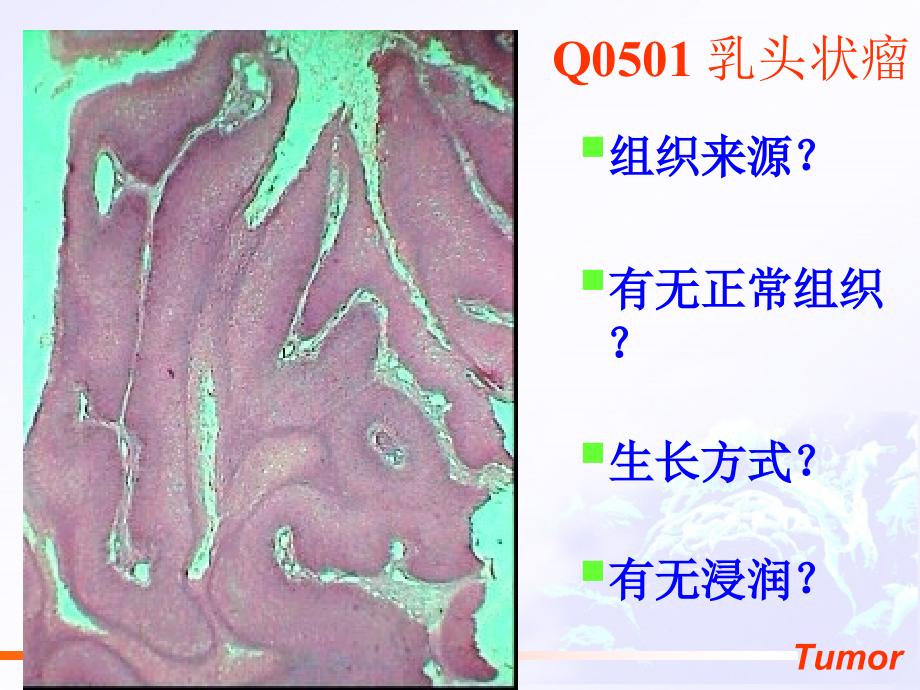 第五章 肿瘤.ppt_第2页
