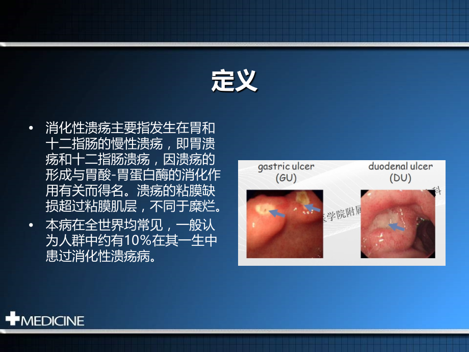 消化性溃疡诊断和治疗规范建议.ppt_第2页