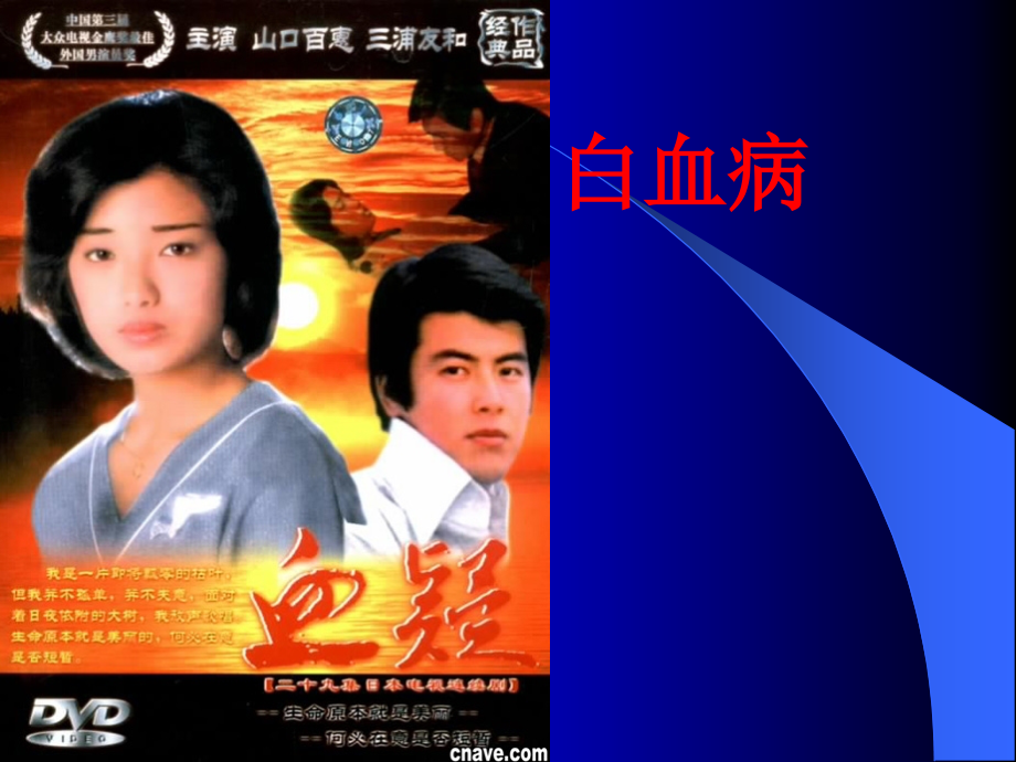 急性白血病本科教学.ppt_第1页