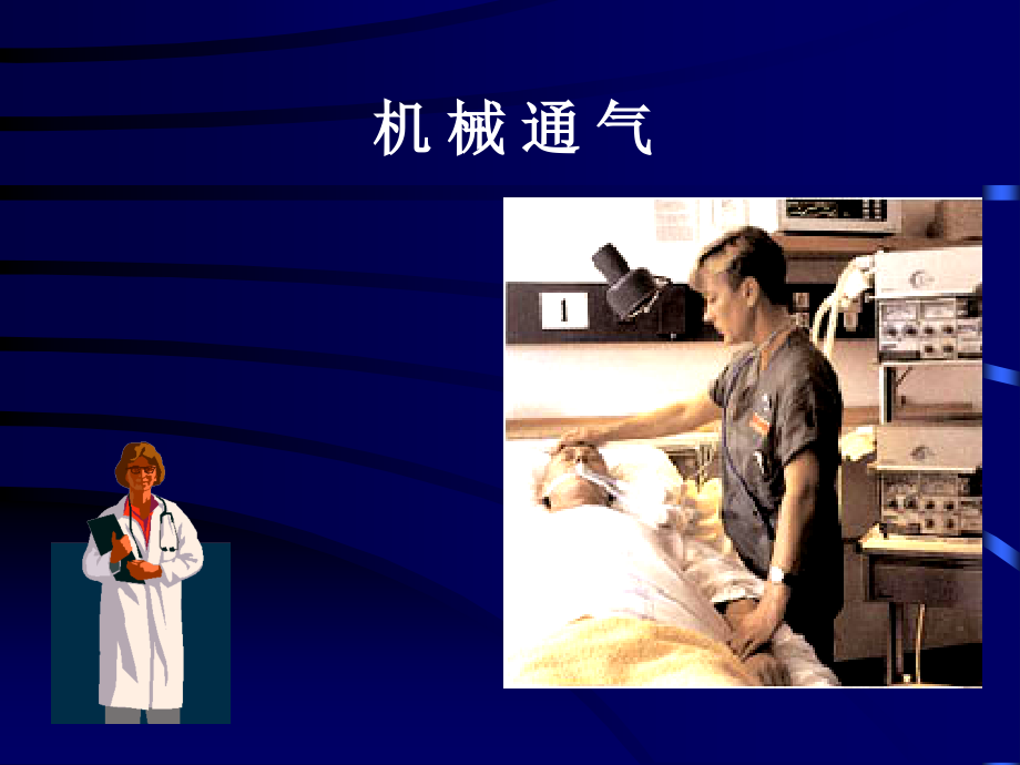 呼吸支持-机械通气.ppt_第1页