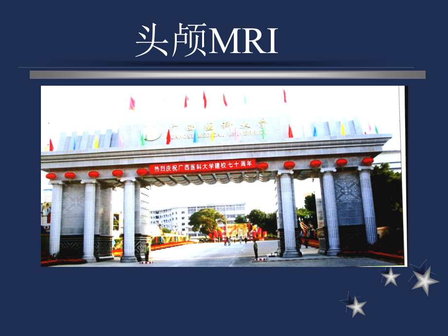 头颅MRI常识.ppt_第1页