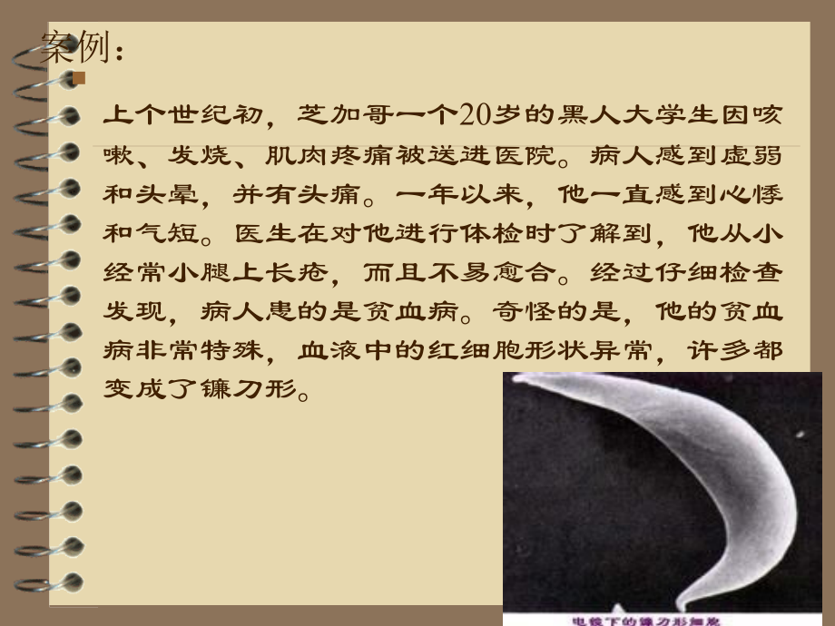 临床六班生化变形的红细胞.ppt_第2页
