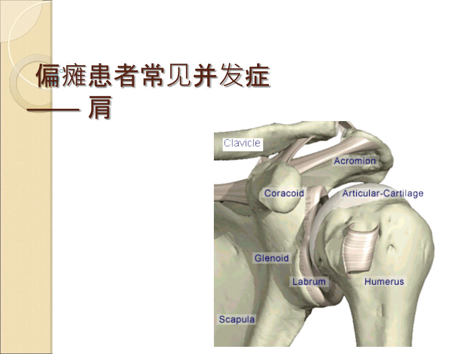 偏瘫肩并发症课件.ppt_第1页