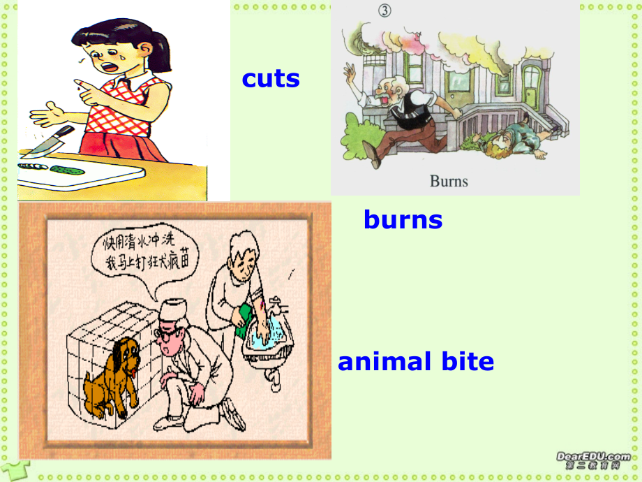高中英语Uunit5 first aid warming up 人教版 课件.ppt_第2页