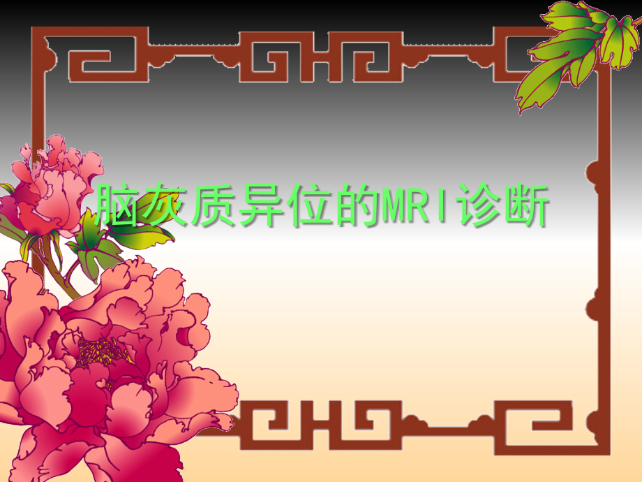 脑灰质异位的MRI诊断课件.ppt_第1页