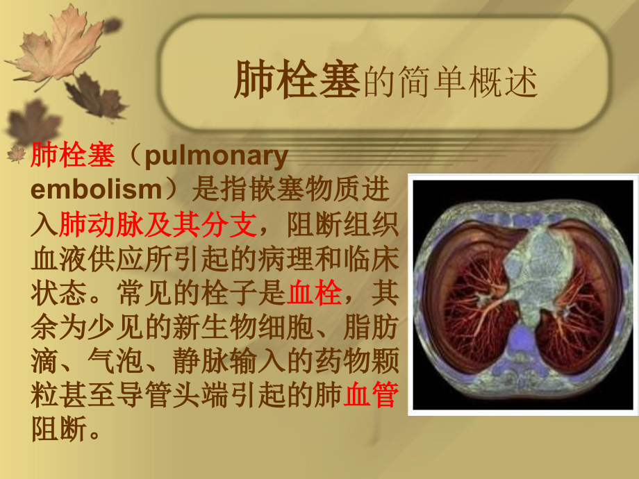 肺栓塞的治疗方案.ppt_第2页
