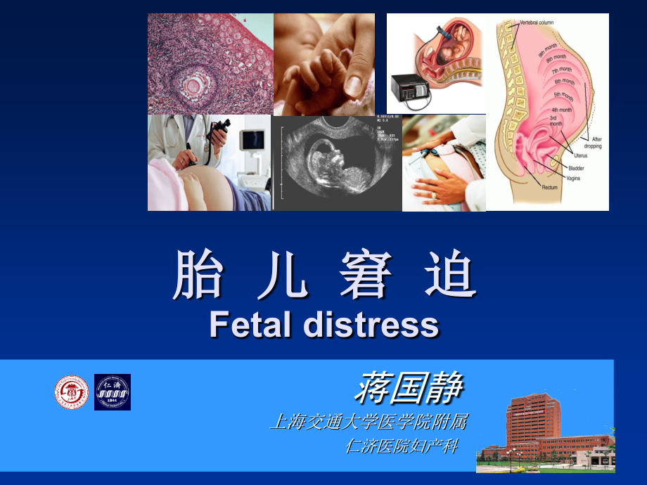 胎儿窘迫Fetaldistress.ppt_第1页