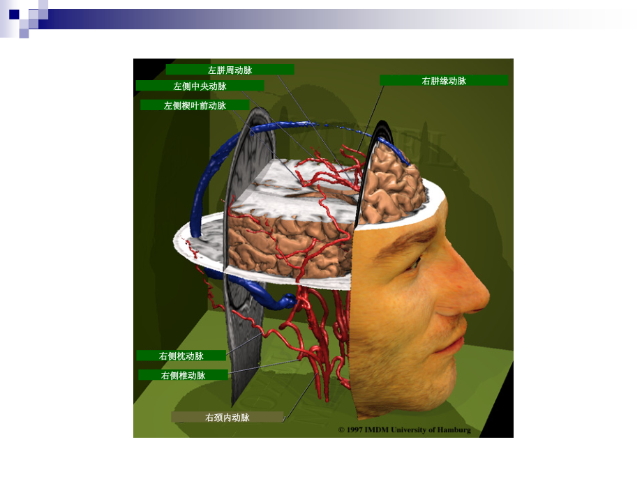 人脑和脑血管解剖分析-课件.ppt_第2页