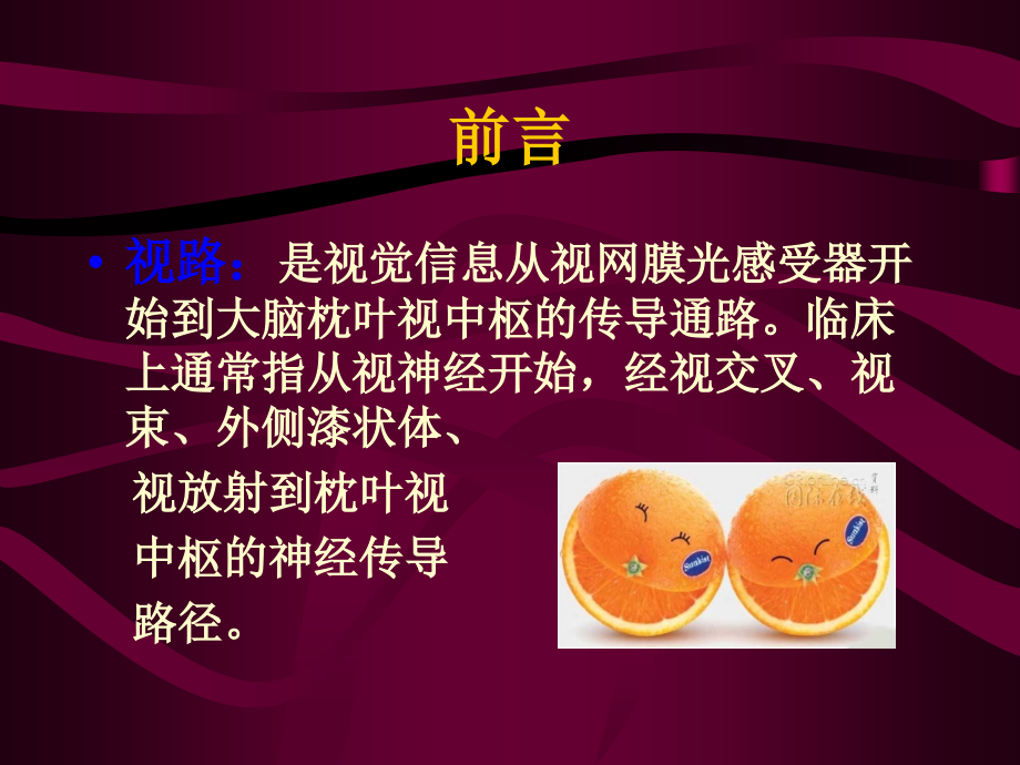 第十五章-视神经及视路疾病课件.ppt_第2页