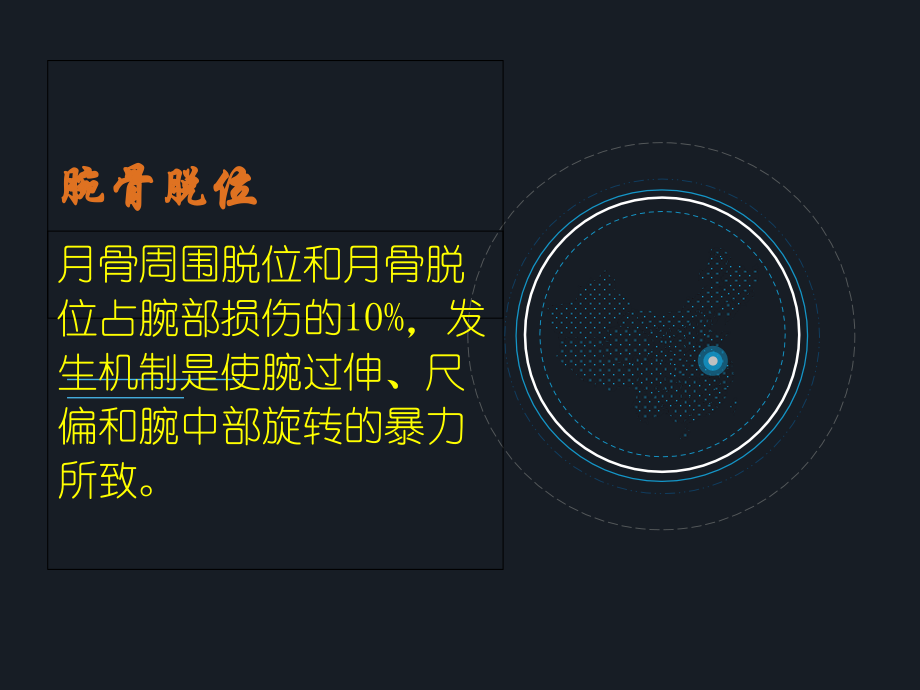 腕骨脱位ppt.ppt_第1页