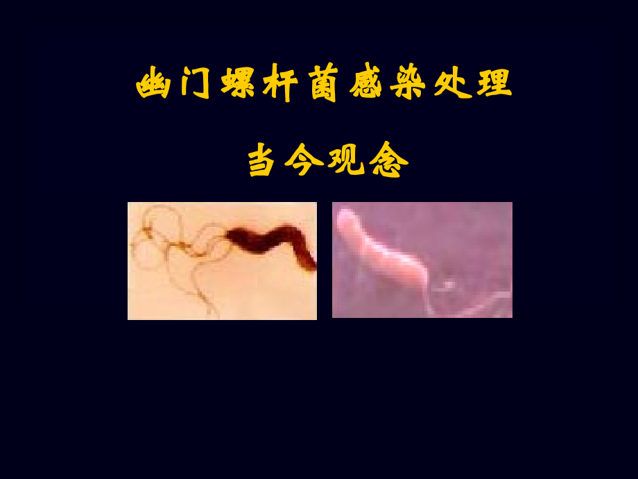 HP治疗新进展课件.ppt_第1页