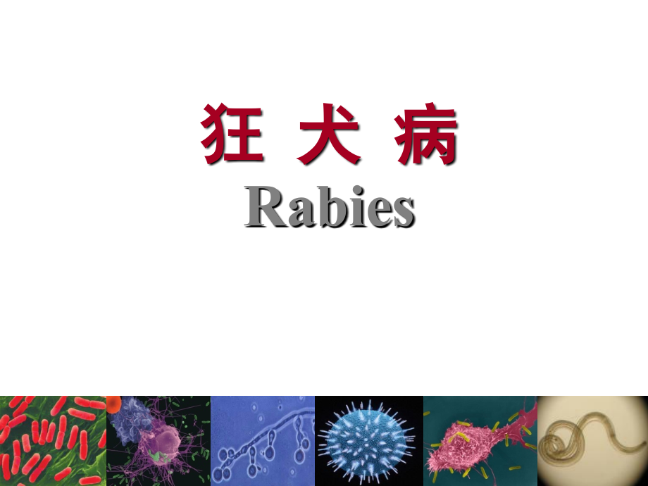 狂犬病诊治课件.ppt_第1页