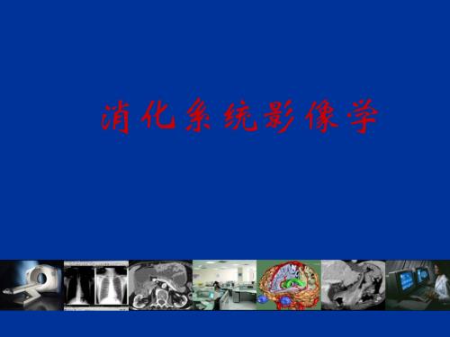 影像诊断02消化系统.ppt