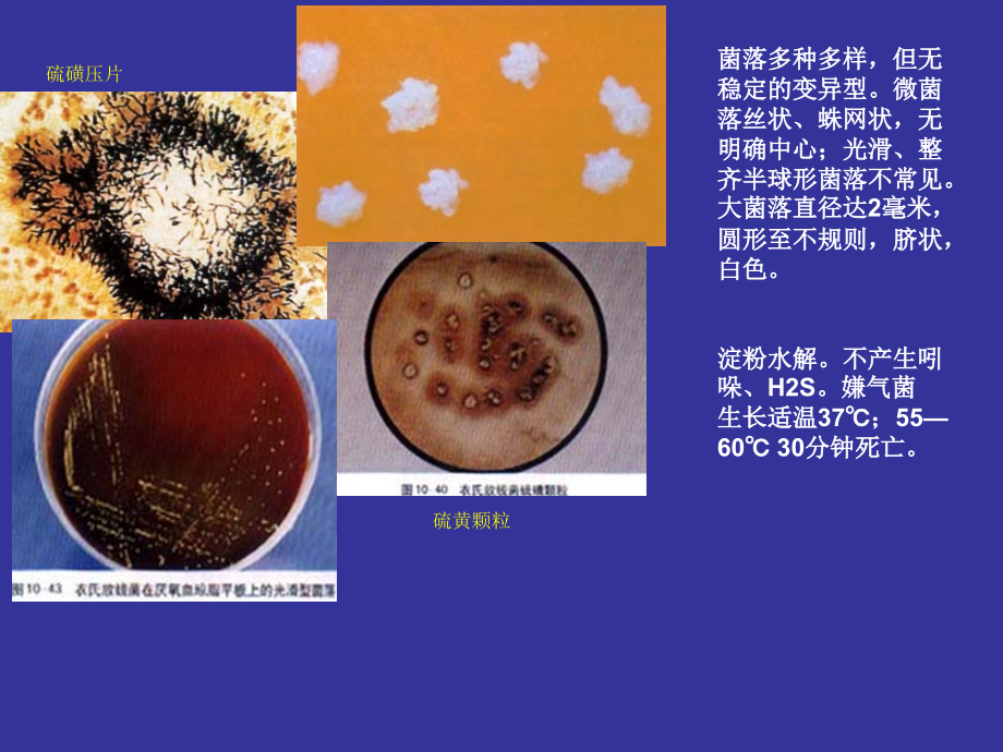 衣氏放线菌.ppt_第2页