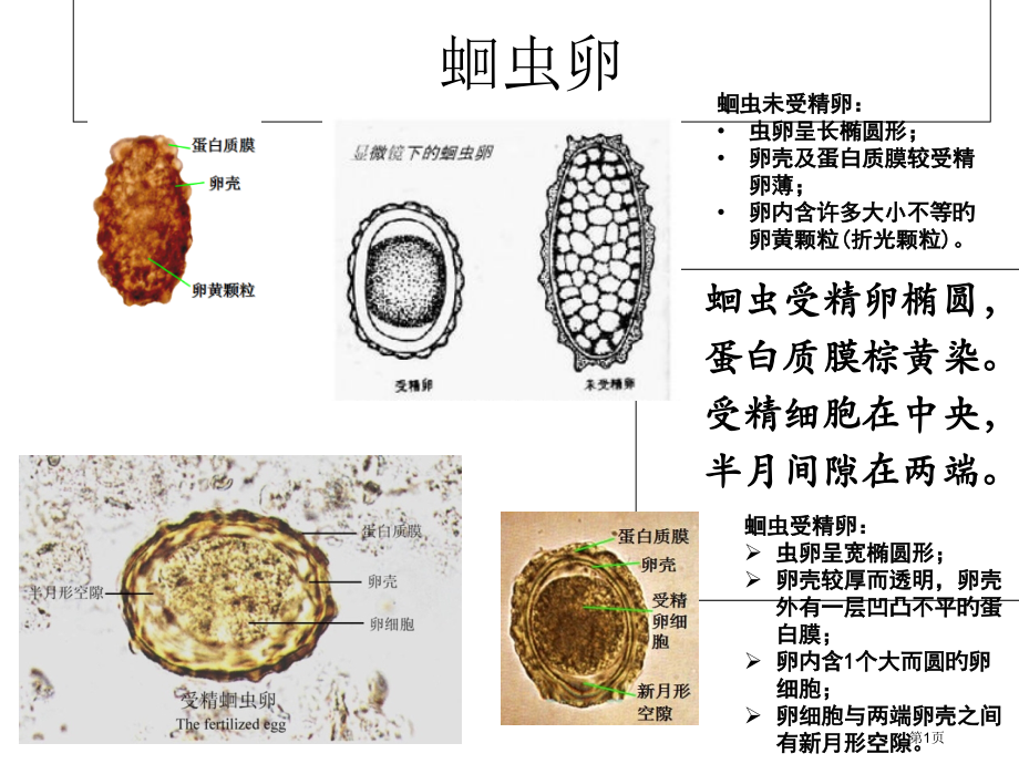 寄生虫学虫卵经典总结和图片.pptx_第1页