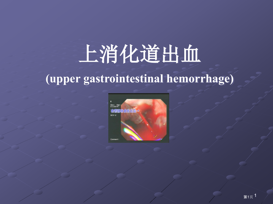 消化道出血讲课.pptx_第1页