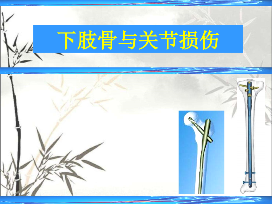 下肢骨与关节损伤.ppt_第1页