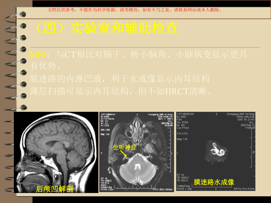 眩晕诊治新进展课件.ppt_第1页