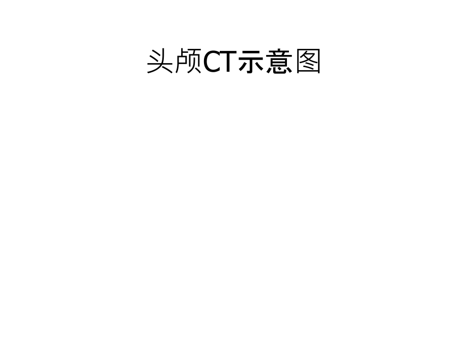颅脑CT示意图.ppt_第1页