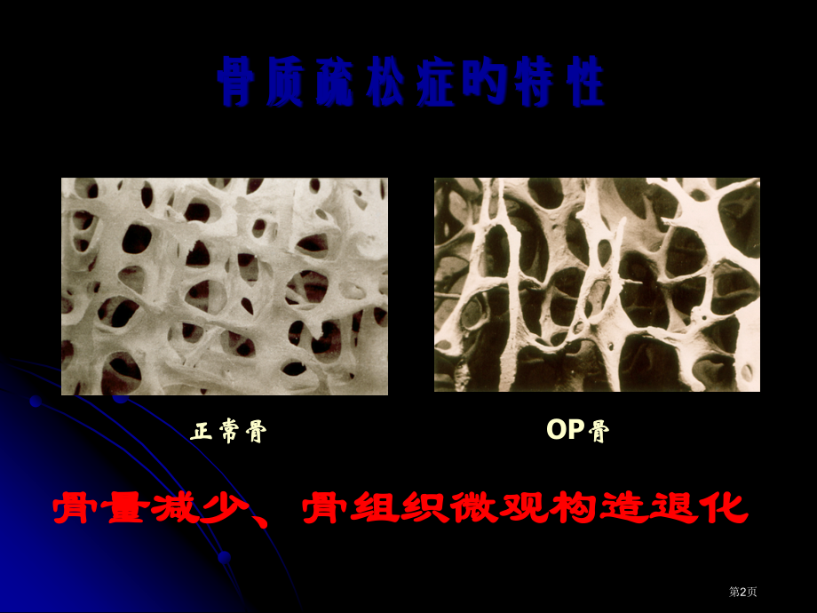 抗骨质疏松中药活性成分的研究进展.pptx_第2页
