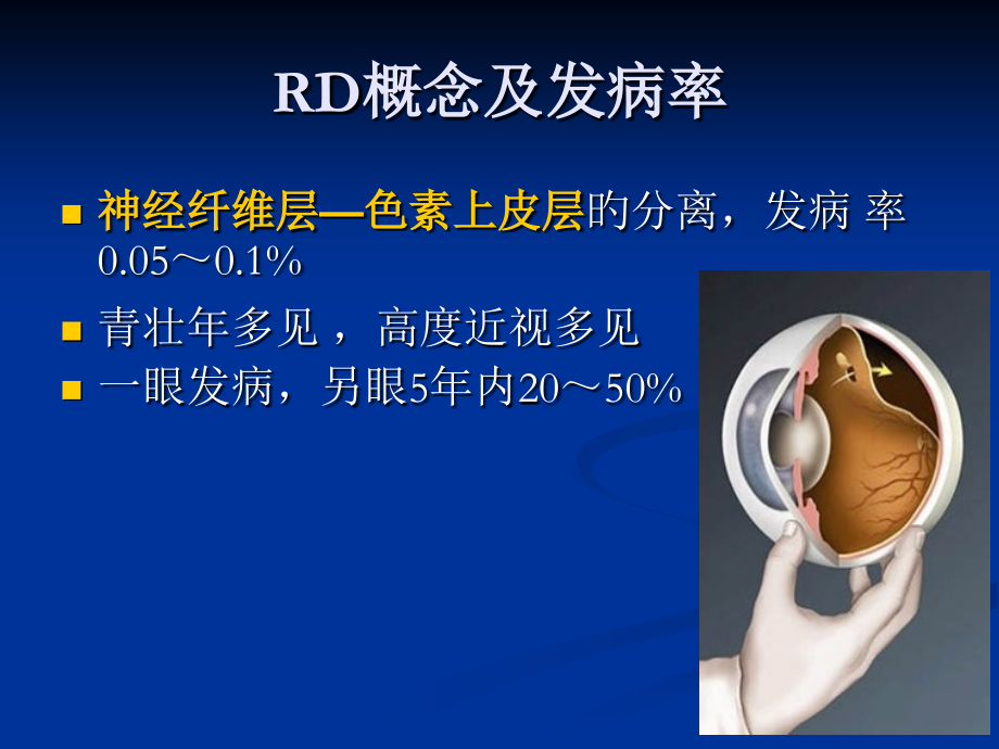 视网膜脱离手术.ppt_第1页