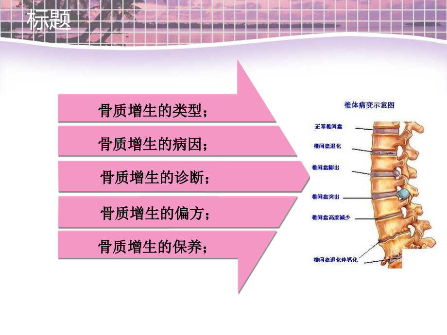 骨质增生的家庭治疗.ppt_第2页