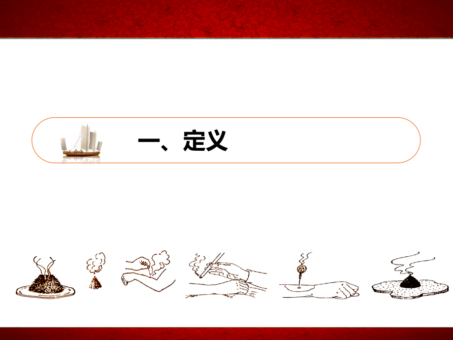 腰痛坐骨神经痛.ppt_第2页