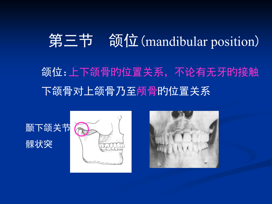 牙列牙合与颌位颌位.ppt_第1页