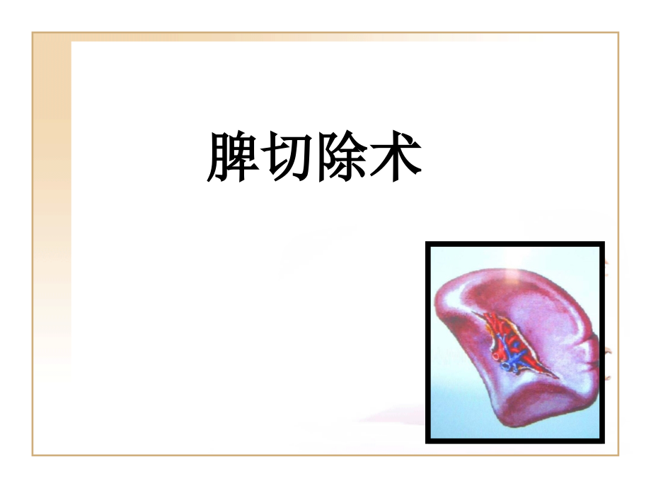 脾切除术获奖公开课课件.pptx_第1页