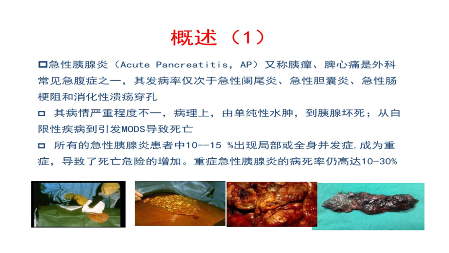 胰腺炎的中医治疗现状.ppt_第2页