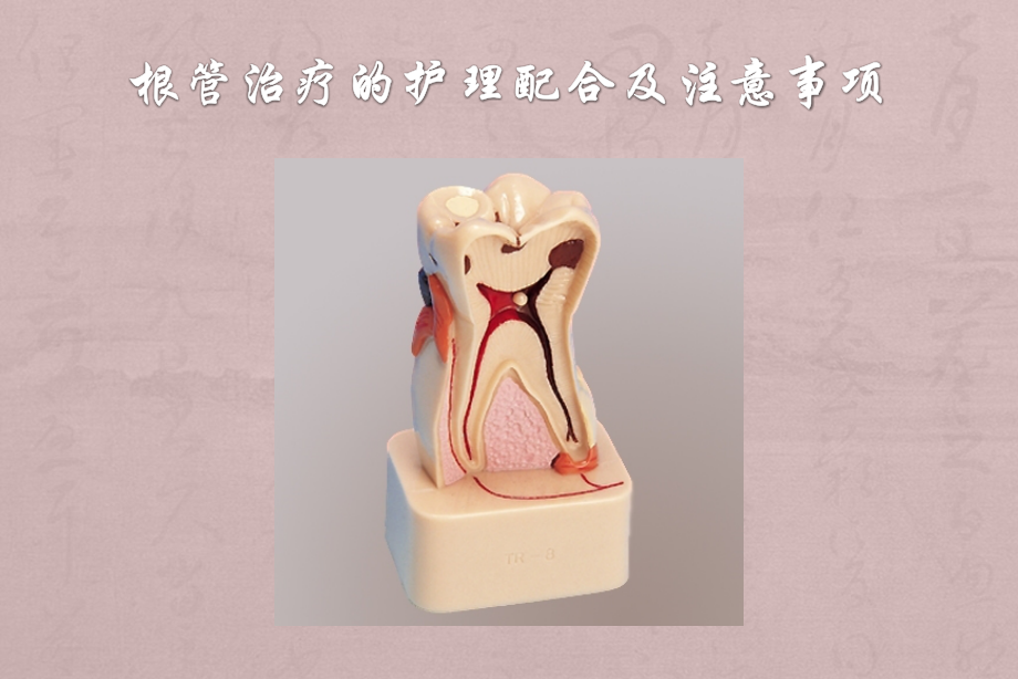 根管治疗护理配合.pptx_第1页