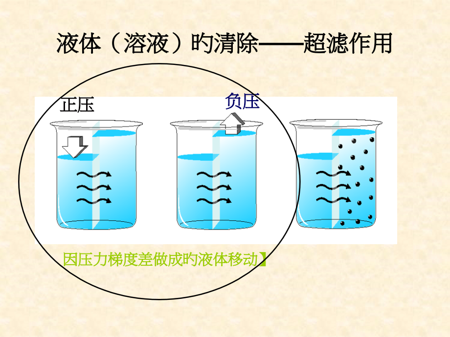 crrt治疗剂量的计算.ppt_第2页