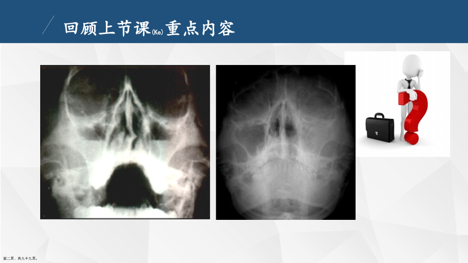 胸部X线检查与诊断及治疗临床病例培训学习.pptx_第2页