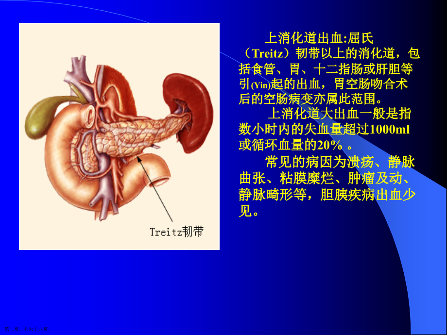 上消化道出血的治疗及案例介绍.pptx_第2页