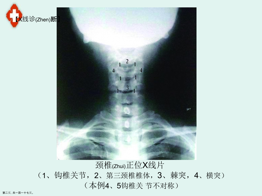脊柱的影像学治疗主题.pptx_第2页