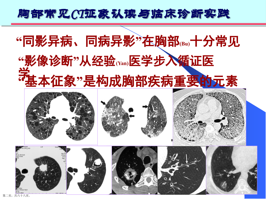 肺部CT十大征象的诊断及治疗必学.pptx_第2页