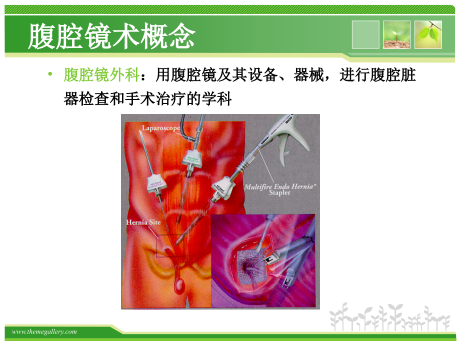 腹腔镜优点.ppt_第2页