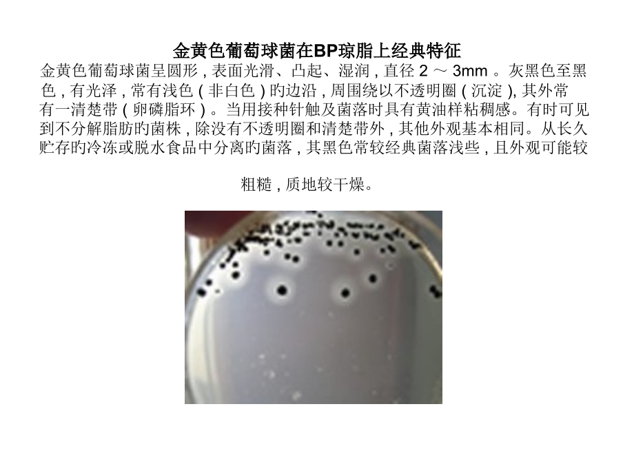 不同微生物在对应培养基上特征市公开课一等奖市赛课金奖课件.pptx_第1页