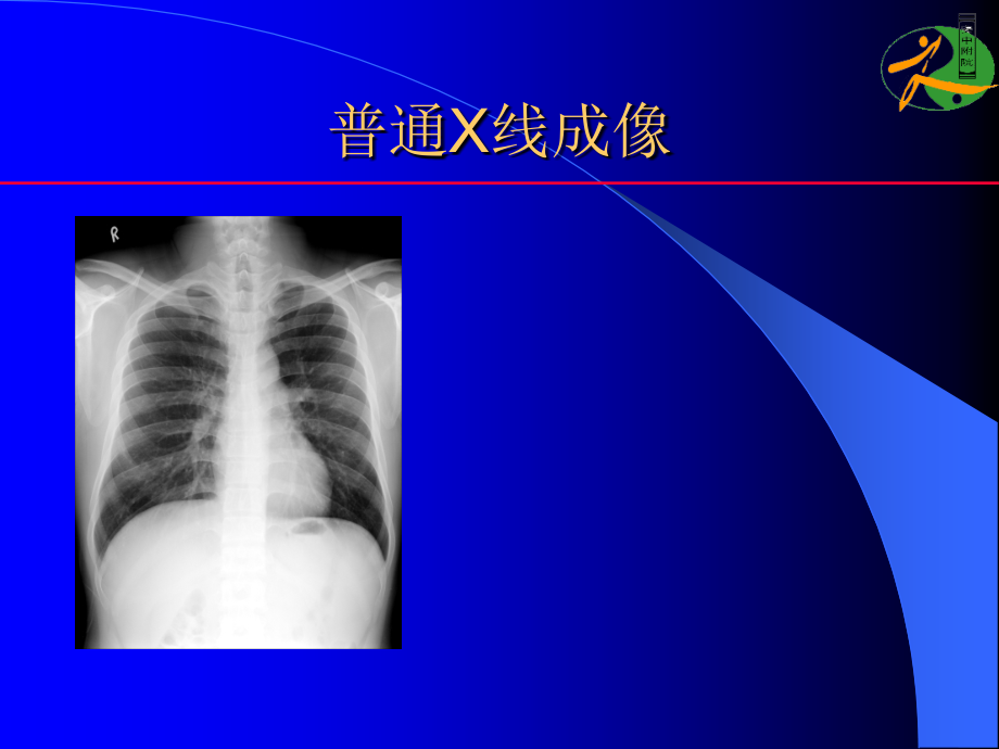 安徽省中医院X线总论.ppt_第1页