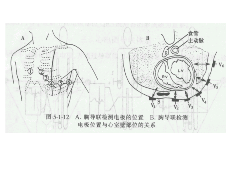 心电图基础知识培训.ppt_第2页