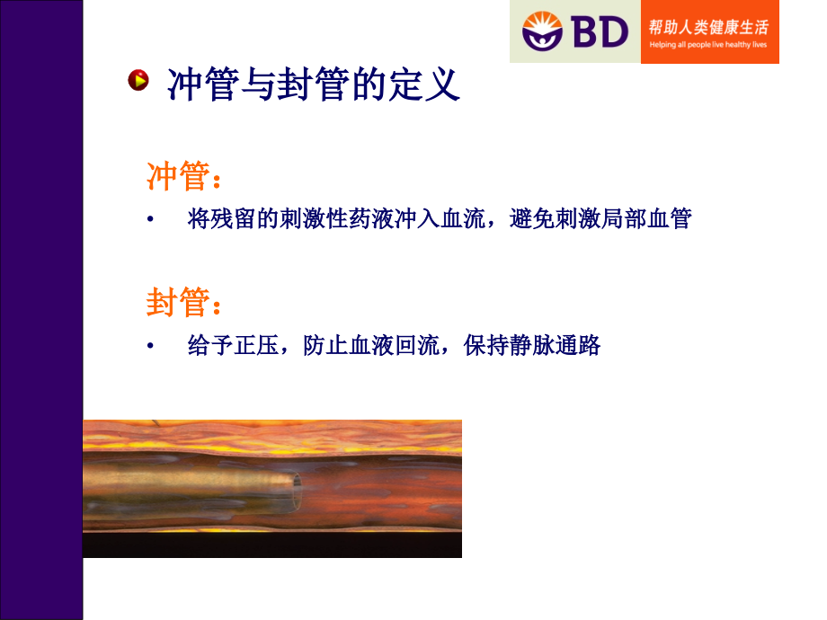 封管冲管10.ppt_第2页