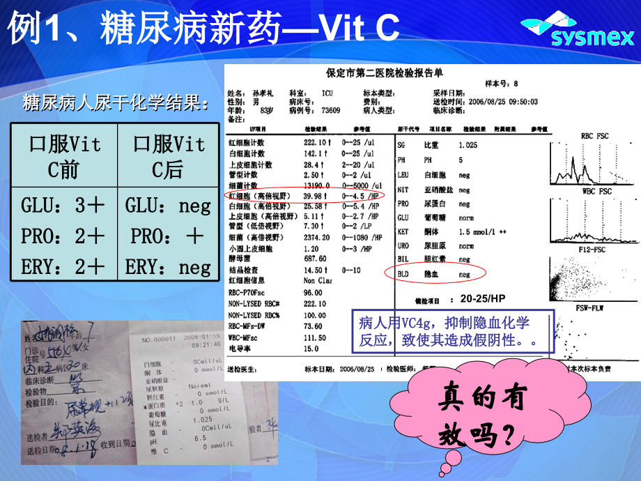 如何看目前的尿常规化验单.ppt_第2页